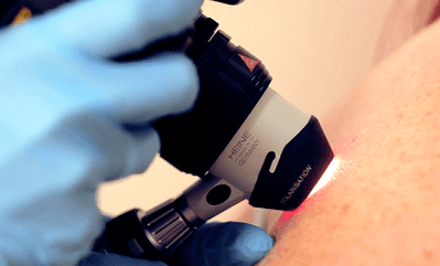 diagnostische methoden voor de plantaire wrat