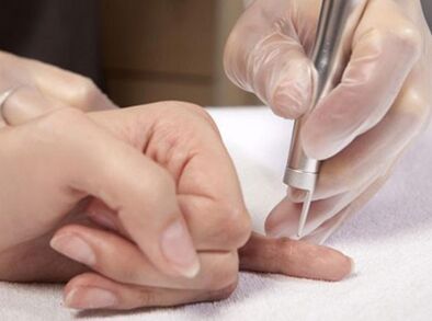 Het uitvoeren van lasertherapie