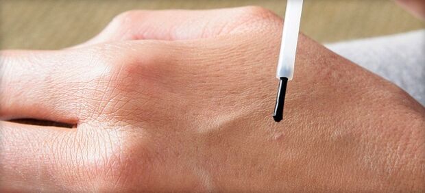 behandeling van wratten met medicijnen